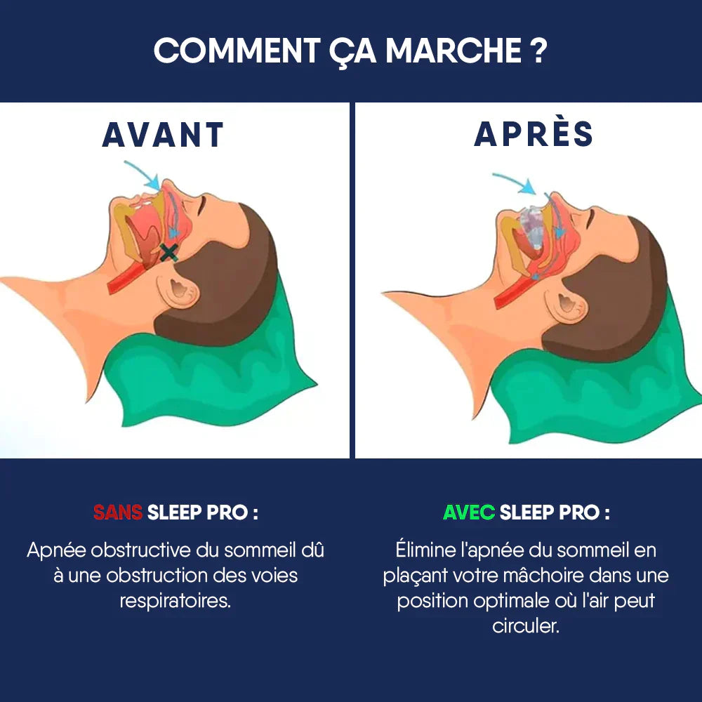 SLEEP PRO - Appareil anti-ronflements et apnée du sommeil